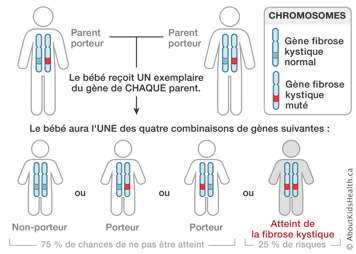 Distribution des chromosomes des parents porteurs de la fibrose kystique