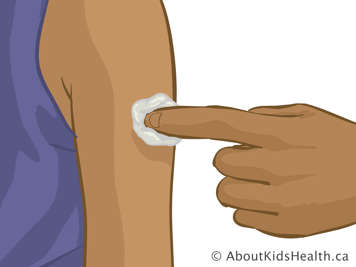 Tenant un tampon d&rsquo;ouate sur la partie sup&eacute;rieure du bras