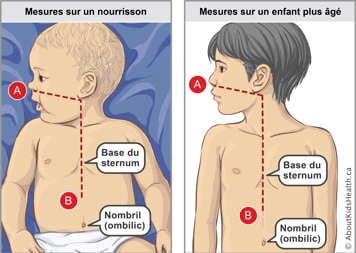 Mesures sur un b&eacute;b&eacute; et sur un enfant plus &acirc;g&eacute;, avec un doigt sur le b&eacute;b&eacute; et deux doigt sur l&rsquo;enfant en-dessous du sternum