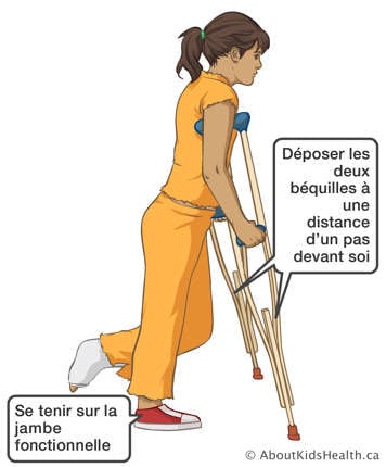 Se tenant sur la jambe fonctionnelle en déposant les deux béquilles à une distance d’un pas devant soi