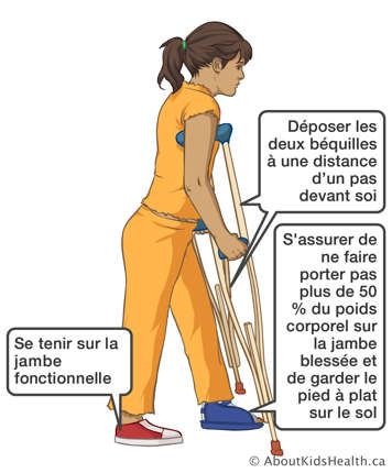 Utilisant les béquilles pour s’assurer que la jambe blessée ne porte pas plus de cinquante pour cent du poids corporel