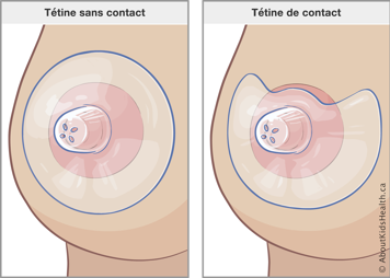 Des seins avec tétine sans contact et avec tétine de contact