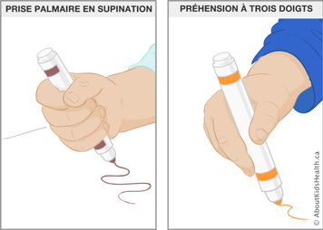 Illustration de la prise palmaire en supination et la préhension à trois doigts d’un marqueur