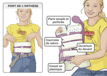 La paroi souple et perforée, les courroies de Velcro, l’ouverture du devant et le corset en plastique sur l’appareil